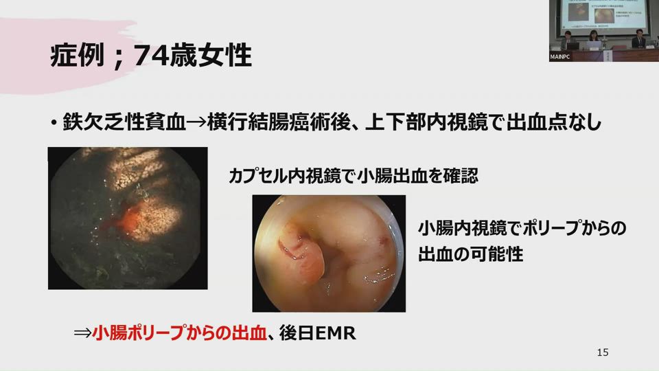 血液の歴史 Amazon.co.jp: 血液の歴史 : ダグラス・スター, 山下 篤子: 本